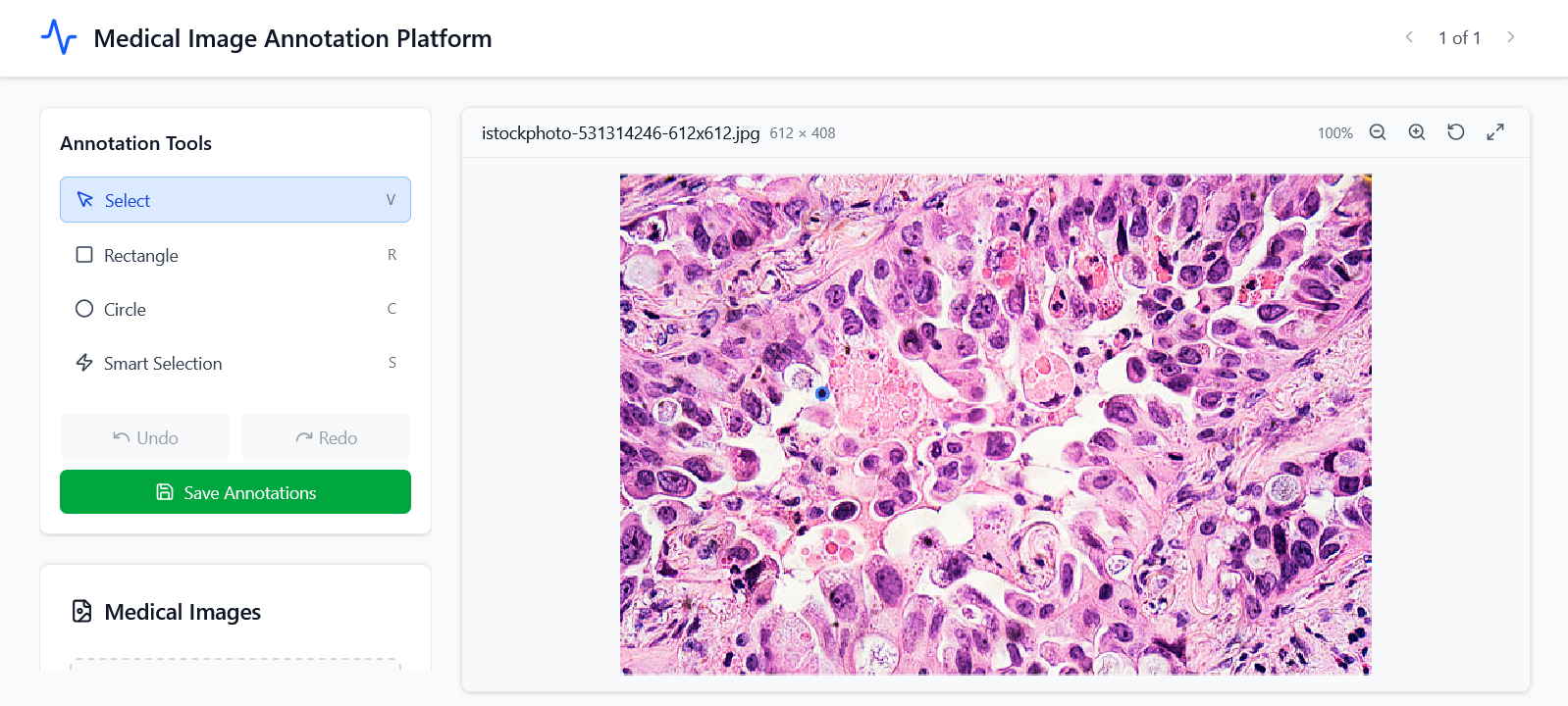 Medical Image Annotation screenshot